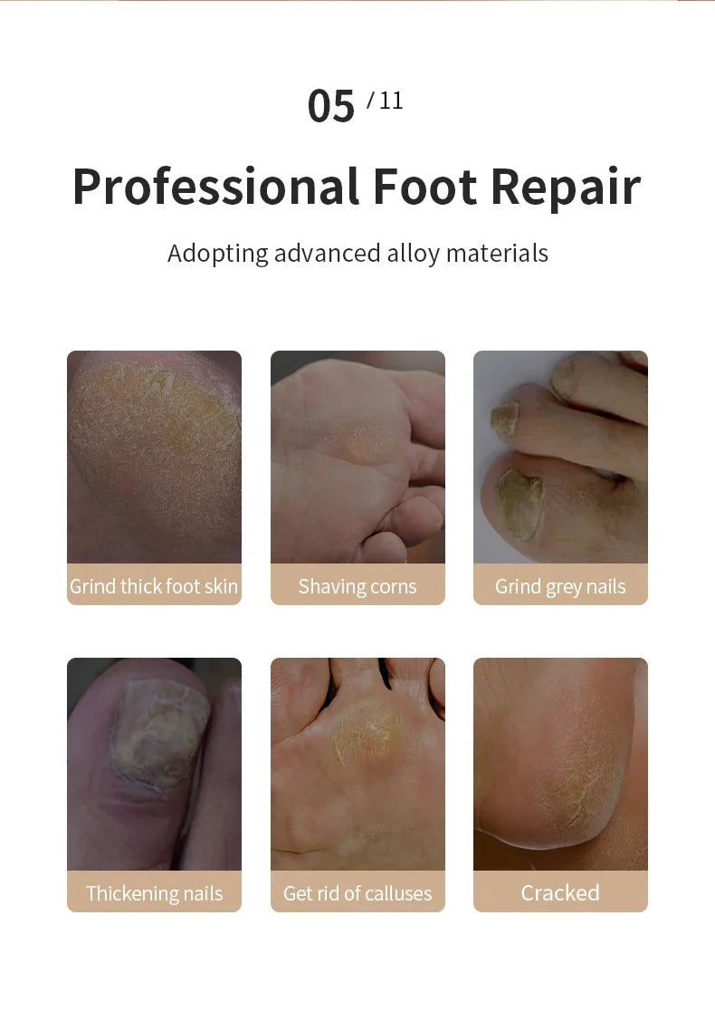 Dead Skin Callus Remover (Summer Sale)
