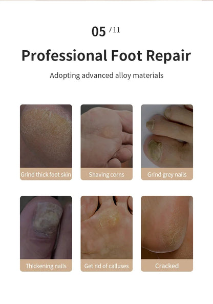 Dead Skin Callus Remover (Summer Sale)